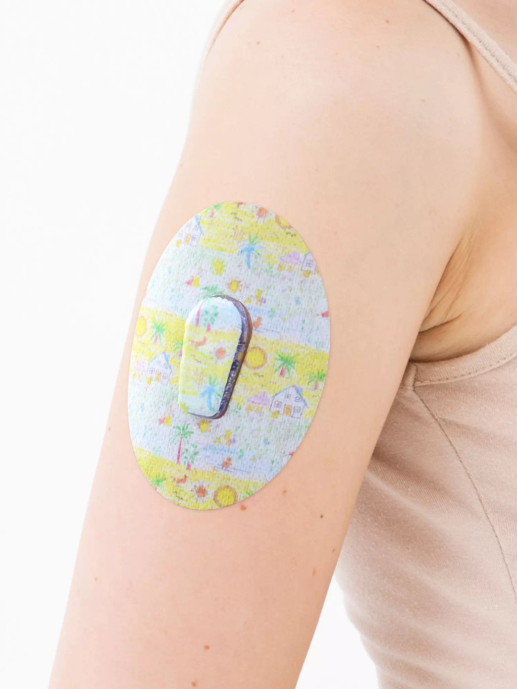 Dexcom G6 adhesive patch, Childhood Memories design, on the arm