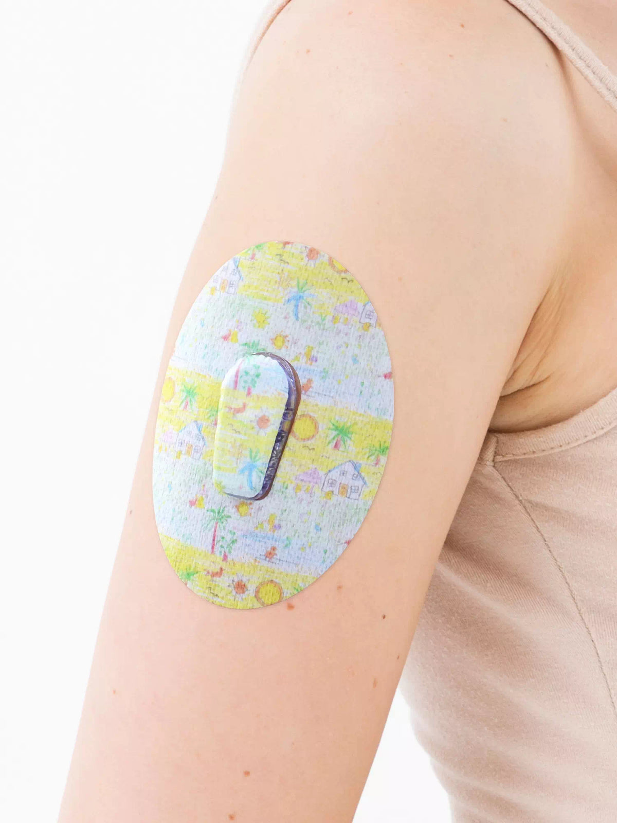 Dexcom G6 adhesive patch, Childhood Memories design, on the arm