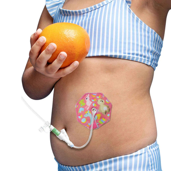 Pediatric G-Tube Pads – Soft, Colorful Comfort for Kids | Kaio-Tube Pads