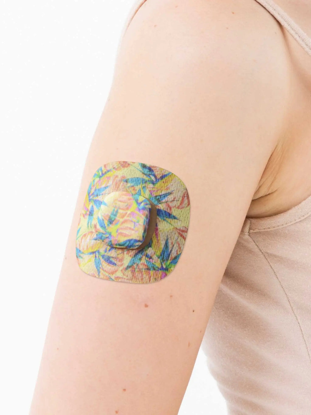 medtronic simplera patch with tropical print worn on arm for secure sensor fixation during daily activity